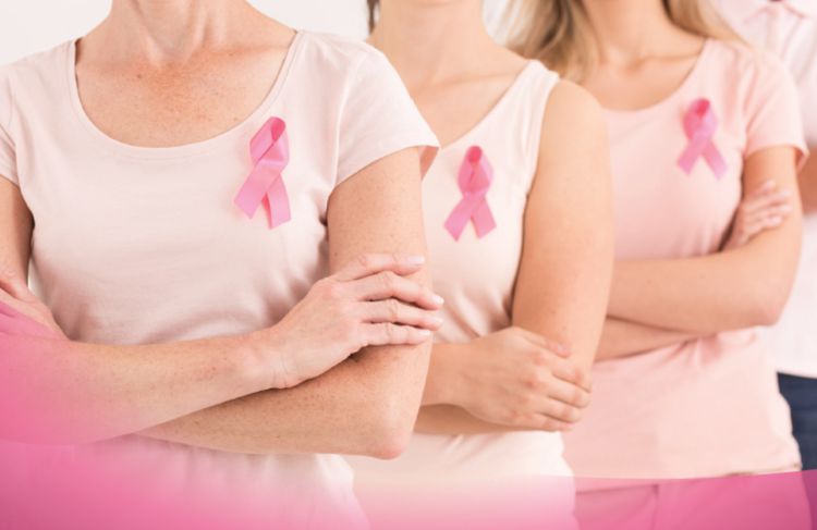 Breast Cancer <strong>and Screening</strong>
